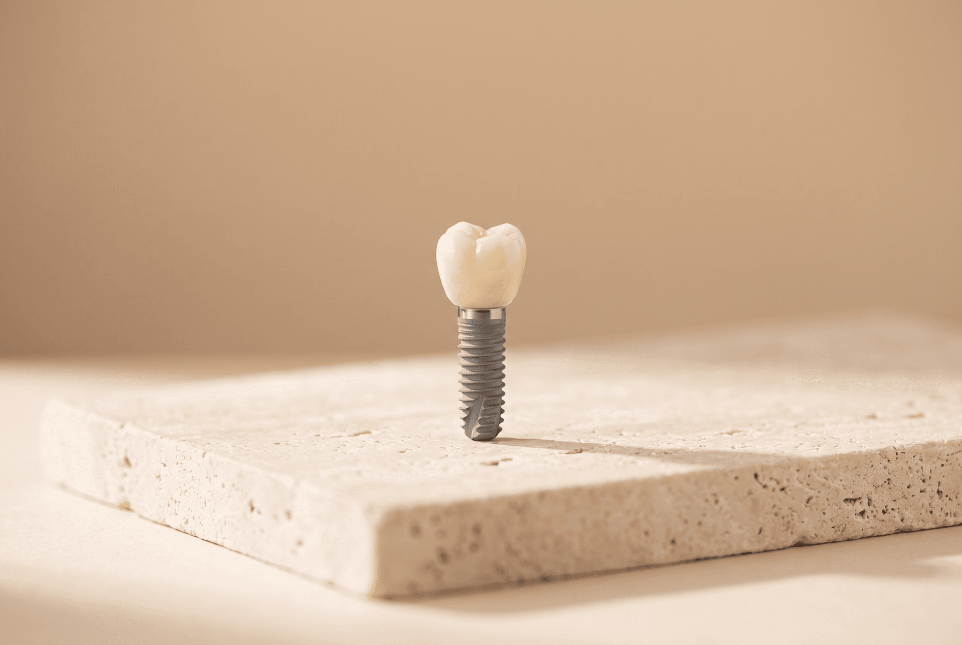 Dental implant model with ceramic crown